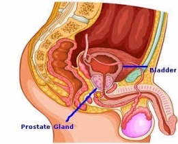 Prostaat